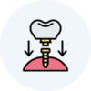 DENTAL-IMPLANTS DENTAL-IMPLANTS